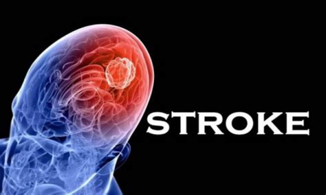 Penyakit Stroke: Apakah Bisa Disembuhkan?